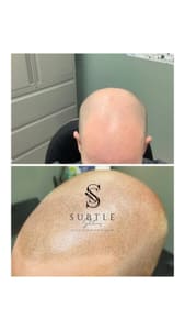 Permanent makeup work by Subtle Solutions Scalp Micropigmentation in Anthem, AZ