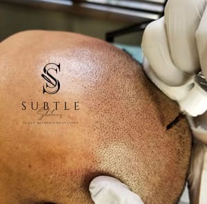 Permanent makeup work by Subtle Solutions Scalp Micropigmentation in Anthem, AZ