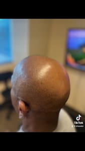 Permanent makeup work by Subtle Solutions Scalp Micropigmentation in Anthem, AZ