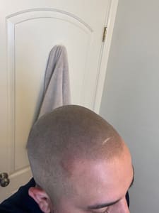 Permanent makeup work by Subtle Solutions Scalp Micropigmentation in Anthem, AZ