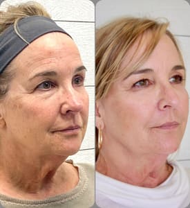 Permanent makeup work by Terri S. Mundy in Vestavia Hills, AL
