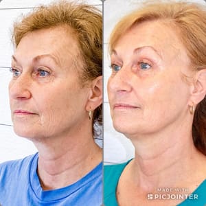 Permanent makeup work by Terri S. Mundy in Vestavia Hills, AL