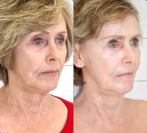 Permanent makeup work by Terri S. Mundy in Vestavia Hills, AL