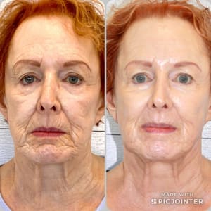 Permanent makeup work by Terri S. Mundy in Vestavia Hills, AL