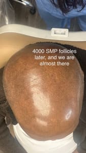 Permanent makeup work by The J. Cornell Clinic for Scar Camouflage & SMP in Hudson, OH