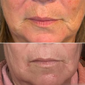 Permanent makeup work by The Vitality House - MedSpa & Wellness Clinic in Lima, OH