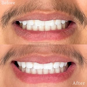Permanent makeup work by Unseen Beauty in Houston, TX