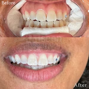 Permanent makeup work by Unseen Beauty in Houston, TX
