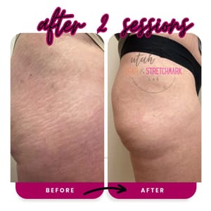 Permanent makeup work by Utah Scar and Stretch Mark Lab in Ogden, UT