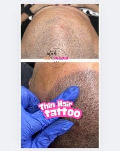 Permanent makeup work by Utah Scar and Stretch Mark Lab in Ogden, UT