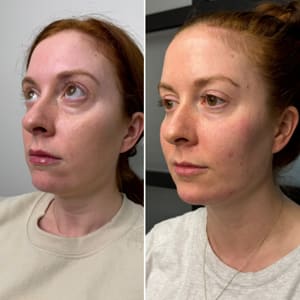 Permanent makeup work by VarAesthetics Medical Spa in Beaver, PA
