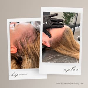 Permanent makeup work by Women’s Scalp Micropigmentation - Fountain of Youth in Roseville, CA