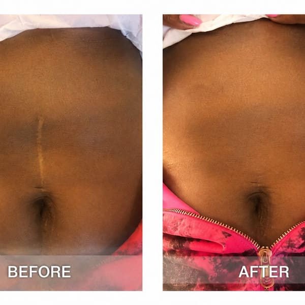 Areola Tattoo - permanent makeup in Austin, TX