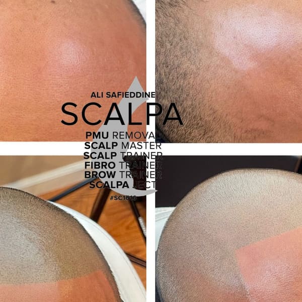 Scalp Aesthetics Dearborn - microblading in Dearborn, MI