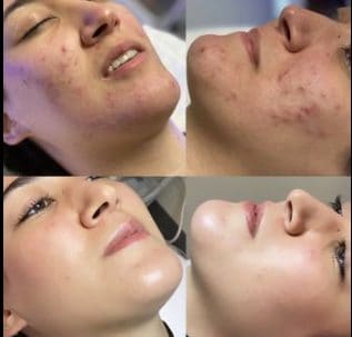 Lotus Skin Care Center - permanent makeup work in Massapequa, NY