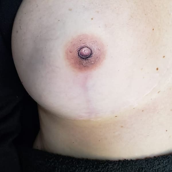 Areola Tattoo - permanent makeup in Dallas, TX
