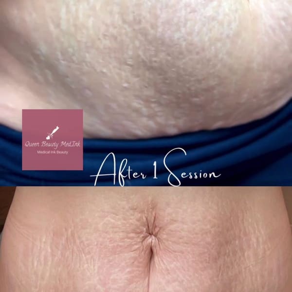 Areola Tattoo - permanent makeup in San Diego, CA