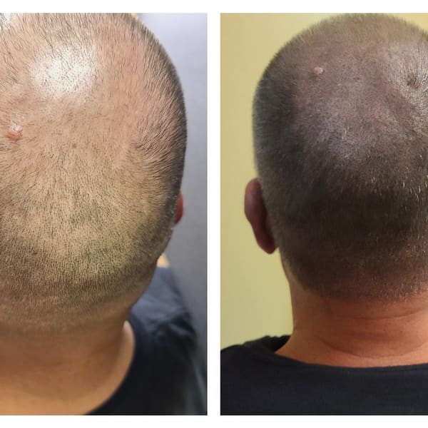 Ink-credible Scalp Micropigmentation - permanent makeup work in Coopersburg, PA