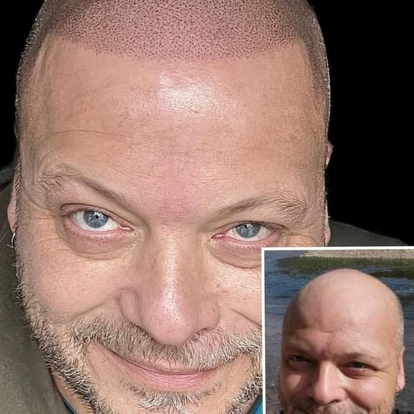 Empowerment Ink Scalp Micropigmentation - permanent makeup work in South Williamsport, PA