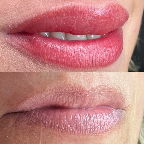 Teles Esthetics Center & Academy - microblading in Lexington, MA
