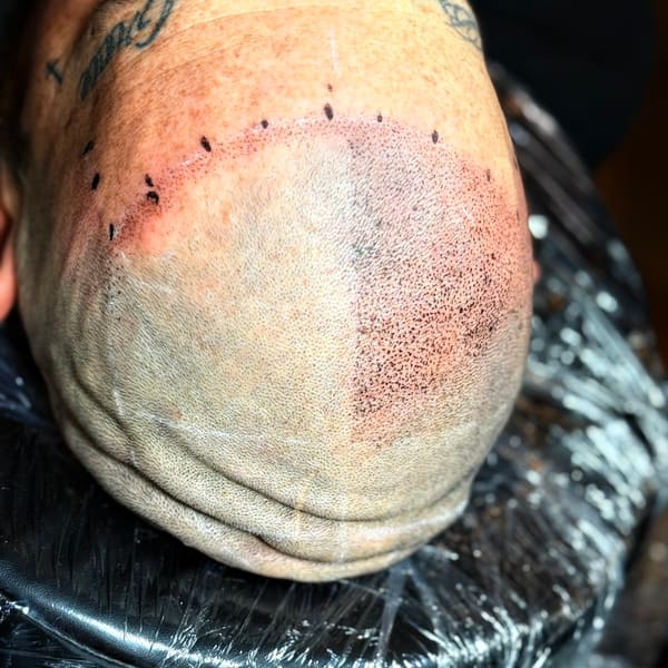 New Mexico SMP Scalp Micropigmentation Clinic - permanent makeup work in Los Ranchos De Albuquerque, NM