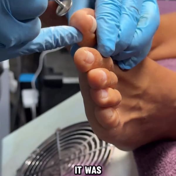 Areola Tattoo - permanent makeup in Boca Raton, FL