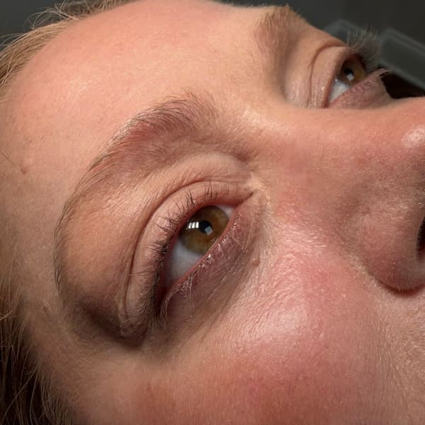 Skin Clinic NY - permanent makeup work in Tuckahoe, NY