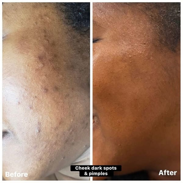 KemSkin Total Beauty - permanent makeup work in Langhorne, PA