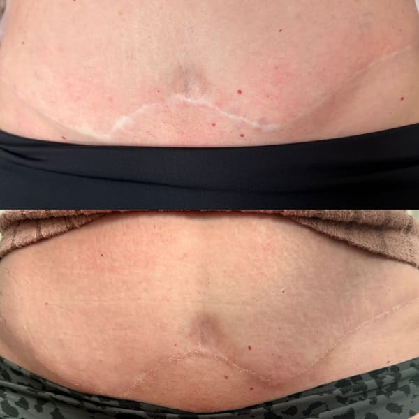 Barely There Tattoo - permanent makeup work in Helper, UT