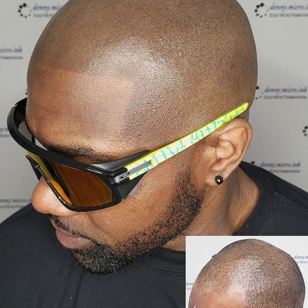 Denny.Micro.Ink Scalp Micropigmentation Houston - permanent makeup work in Bellaire, TX