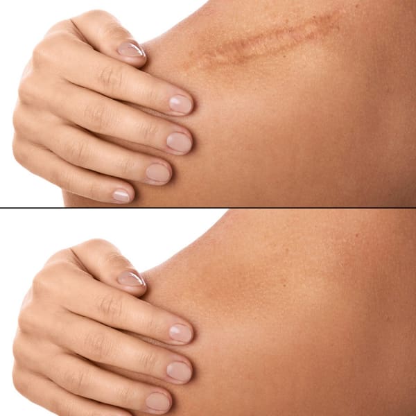 PMU Scar Clinic - permanent makeup in Henderson, NV