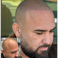Precise Scalp Micropigmentation Service & Training in Rancho Cucamonga CA - permanent makeup work