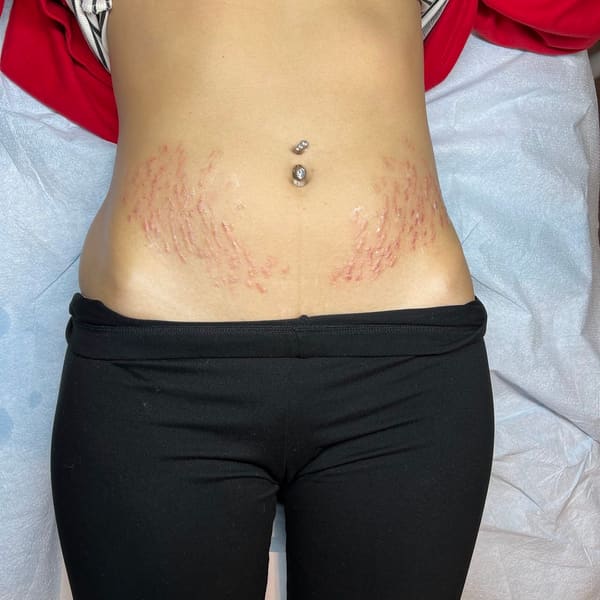 Queen Beauty Medink - permanent makeup in San Diego, CA