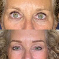 Radiance & Precision Aesthetics & Permanent Makeup - permanent makeup work