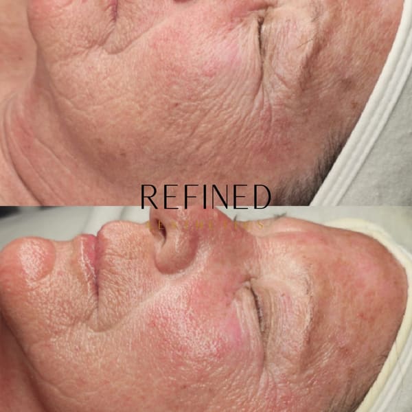 Refined Aesthetics - St. Pete facials and waxing - permanent makeup in Kenneth City, FL