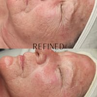 Refined Aesthetics - St. Pete facials and waxing - permanent makeup work