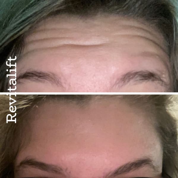 Revitalift Aesthetic Center - permanent makeup in Lincoln, NE