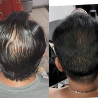 Rick Lesser Hair, Makeup, Micro-needling - permanent makeup work