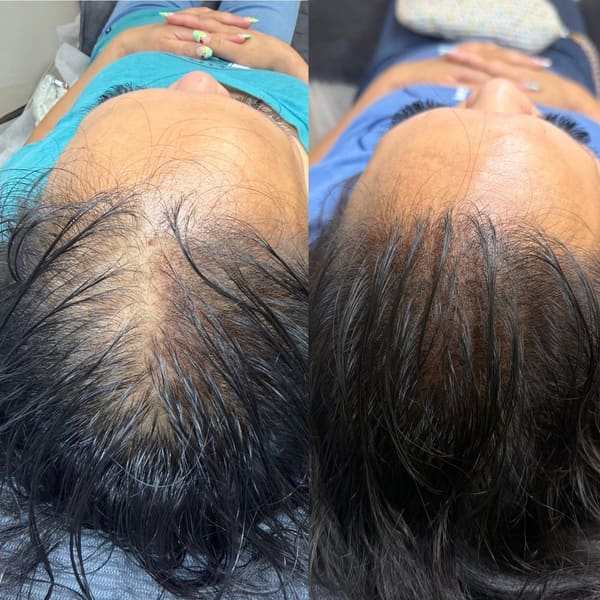 Rose Beauty Bar - permanent makeup in Walnut Creek, CA