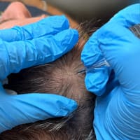 Saz Studio Inks Scalp Micropigmentation - permanent makeup work
