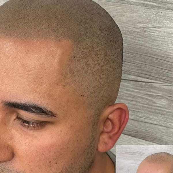 Scalp Co. Scalp Micropigmentation - permanent makeup in Parker, CO