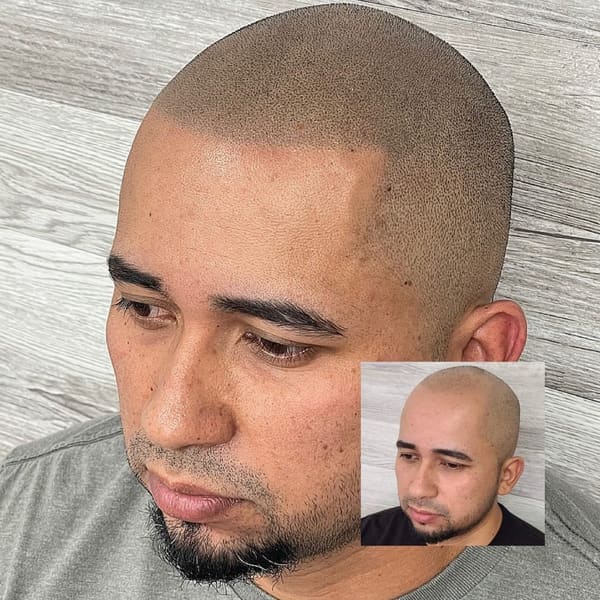 Scalp Co. Scalp Micropigmentation - permanent makeup in Vacaville, CA