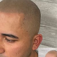 Scalp Co. Scalp Micropigmentation - permanent makeup work