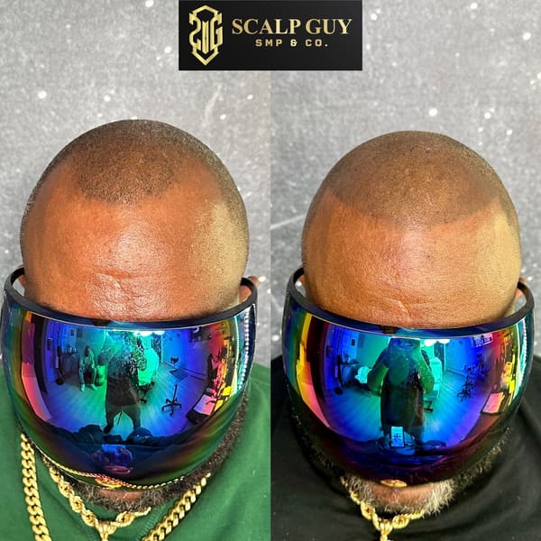 Scalp Guy SMP & Co - permanent makeup in Wilmington, MA