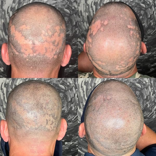 Scalp Headquarters LLC - permanent makeup in Kansas City, MO