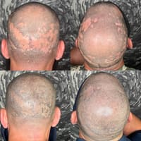 Scalp Headquarters LLC - permanent makeup work