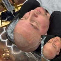 Scalp Micro M3 - permanent makeup work