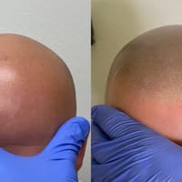 Scalp Micro Tampa Bay - permanent makeup work