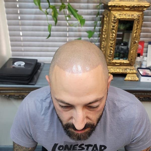 Scalp micropigmentatation (SMP) by AnnaTina Mendoza - permanent makeup in Midland, TX
