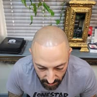 Scalp micropigmentatation (SMP) by AnnaTina Mendoza - permanent makeup work